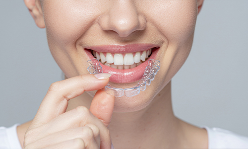 best dental clinic in trivandrum