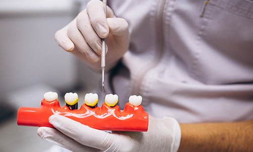 best dental clinic in trivandrum